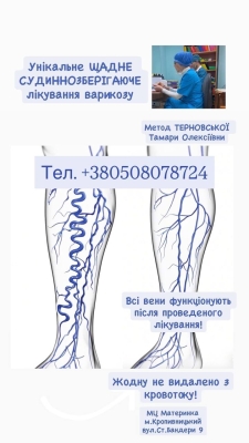 венозна сіточка, початок варикозу, метод Терновської Т.О., збереження клапанів, відновлення вен, профілактика варикозу, амбулаторне лікування венозна сіточка, початок варикозу, метод Терновської Т.О., збереження клапанів, відновлення вен, профілактика варикозу, амбулаторне лікування