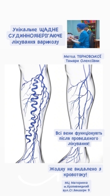 проварикоз, тромбофлебіт, адекватне харчування