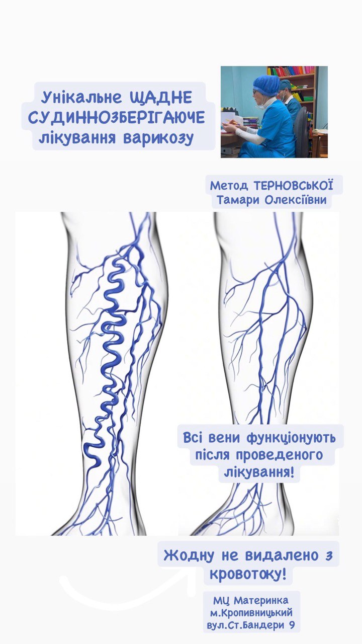 проварикоз, тромбофлебіт, адекватне харчування