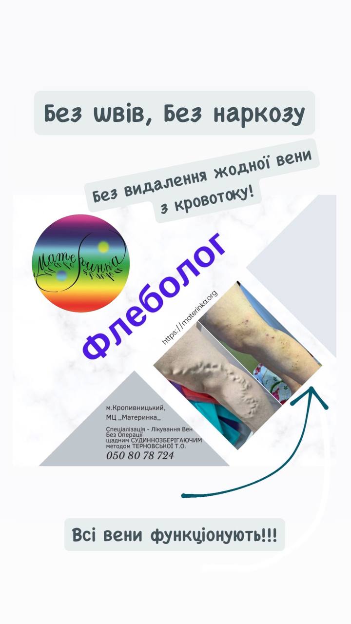вибір методу лікування варикозу, навіщо обирати судиннозберігаючий метод а не лазер